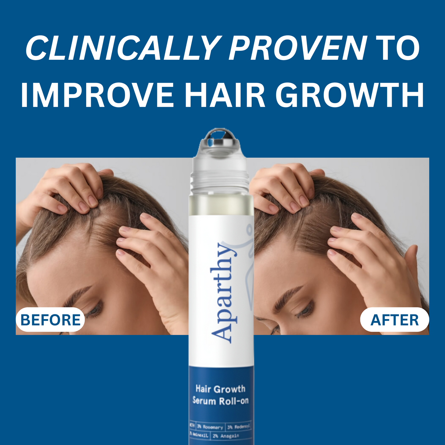 Hair Growth Roll-On Serum | Strengthen Roots & Boost Natural Growth with Redensyl, AnaGain & Rosemary