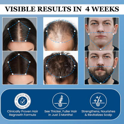 Hair Growth Roll-On Serum | Strengthen Roots & Boost Natural Growth with Redensyl, AnaGain & Rosemary