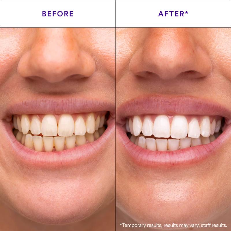 PAP+ Whitening Strips, Dazzling whitening strips, teeth whitening strips